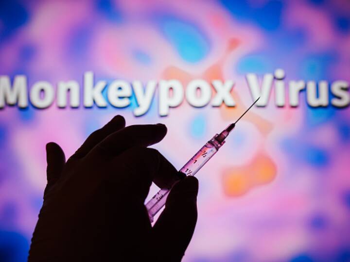 Monkeypox In India: Himachal Man With No Foreign Travel Suspected To Be Infected With Virus Monkeypox In India: Himachal Man With No Foreign Travel Suspected To Be Infected With Virus