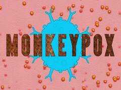 Monkeypox Virus: अब तक 9 केस की हुई पुष्टि, मंकीपॉक्स से कैसे बचें और क्या करें? स्वास्थ्य मंत्रालय ने जारी किए दिशाृ-निर्देश