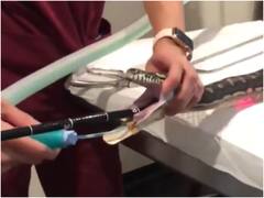 Watch: सांप के मुंह में फंसा कपड़े का टुकड़ा, डॉक्टरों ने ऑपरेशन कर निकाला बाहर