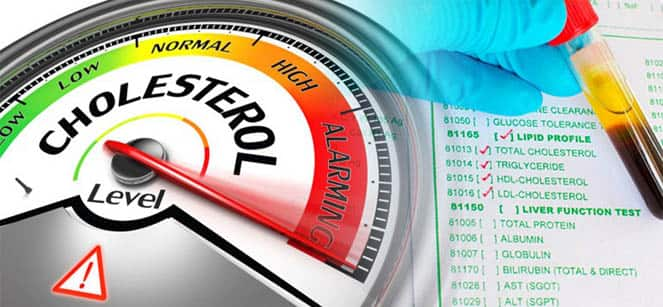 Cholesterol: Symptoms of high cholesterol can also be seen on the skin, this is how you can recognize it Cholesterol : ਸਕਿਨ 'ਤੇ ਵੀ ਦਿਖਾਈ ਦਿੰਦੇ ਨੇ ਹਾਈ ਕੋਲੈਸਟ੍ਰਾਲ ਦੇ ਲੱਛਣ, ਇਸ ਤਰ੍ਹਾਂ ਕਰ ਸਕਦੇ ਹੋ ਪਛਾਣੋ