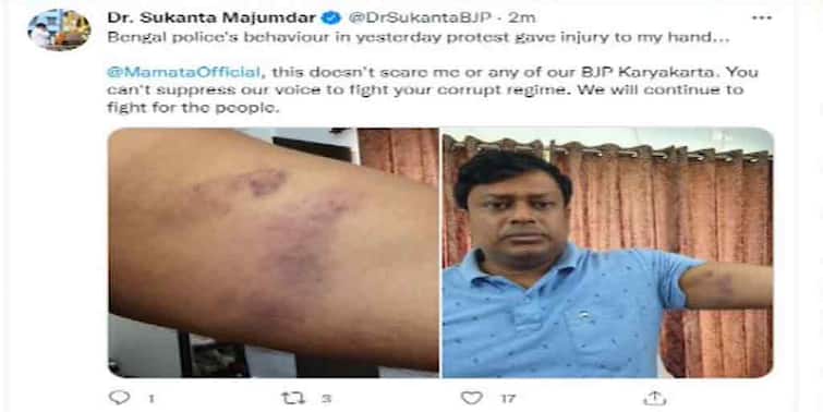 Sukanta Majumder Tweets On Injury In Alleged Clash Police Sukanta Injured: পুলিশের সঙ্গে ধস্তাধস্তিতে চোটের অভিযোগ, ট্যুইটারে মুখ্যমন্ত্রীকে কী 'বার্তা' সুকান্ত মজুমদারের?