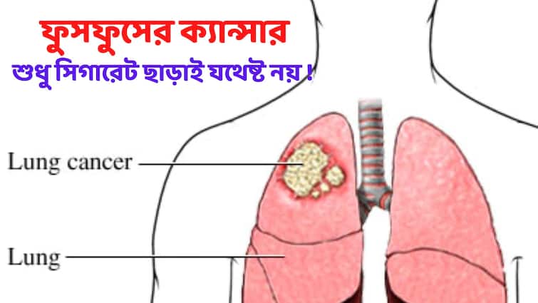 World Lung Cancer Day 2022 Know few Lifestyle changes to reduce risk of lung cancer World Lung Cancer Day : শুধু ধূমপান ছাড়লেই হবে না, ফুসফুসের ক্যান্সার এড়াতে আর যা যা করণীয়