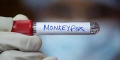 Monkeypox Death In India: কেরলে মৃত তরুণের দেহে মাঙ্কিপক্সেরই সংক্রমণ, ভারতের 'প্রথম ঘটনায়' চাঞ্চল্য