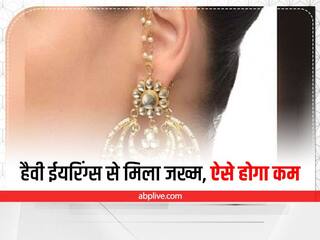 Beauty Tips: हैवी ईयरिंग्स पहनने से कान में हो गया जख्म, तो अपनाएं ये नुस्खे, मिलेगी राहत