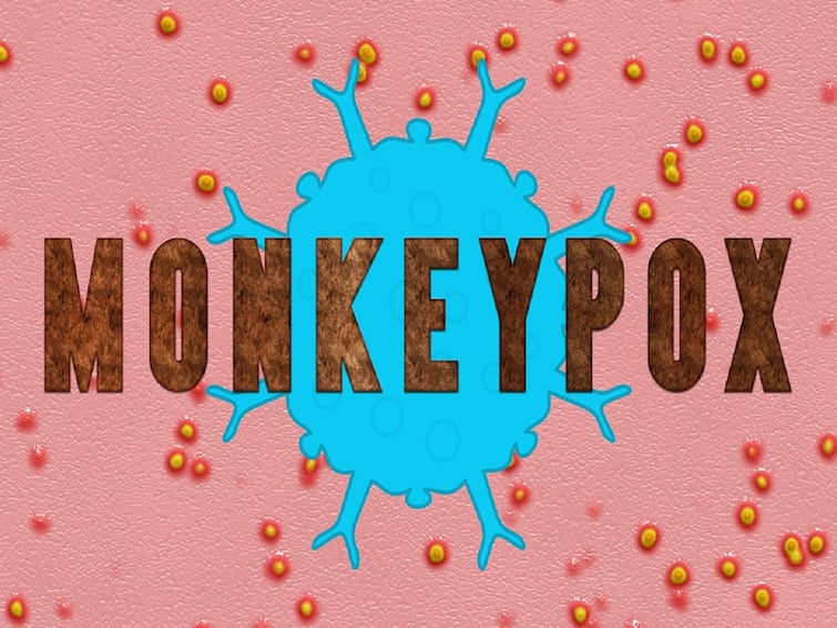 Is Monkeypox A Virus Or Disease Monkeypox Virus : મંકીપોક્સ વાયરસ છે કે કોઈ બીમારી? જાણો શું કહે છે એક્સપર્ટ