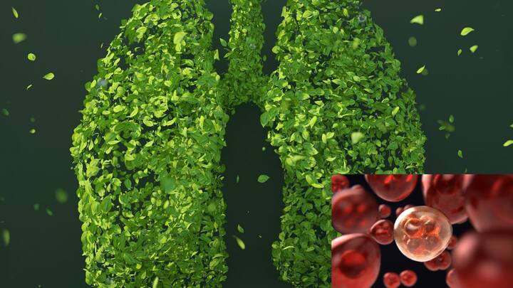 World Lung Cancer Day:লাং ক্যানসার। সহজ বাংলায় ফুসফুসের ক্যানসার। কিন্তু 'ধূমপান ক্যানসারের কারণ' এই জাতীয় বিধিসম্মত সতর্কীকরণ ছাড়া রোগটি সম্পর্কে কতটুকু জানি আমরা?