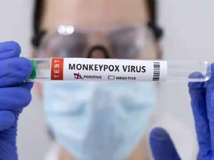 Delhi reports 4th monkeypox case as 31-year-old Nigerian woman tests positive; India's tally now nine: sources Monkeypox Cases in Delhi: મંકીપોક્સના વધતા કેસ, હવે દિલ્હીમાં 31 વર્ષની મહિલા થઈ સંક્રમિત, કુલ કેસની સંખ્યા...