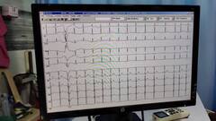 Research : ईसीजी जॅकेटनं हॉर्ट अटॅकचं घरच्या घरी निदान, सोलापूरच्या डॉक्टरचा भन्नाट शोध