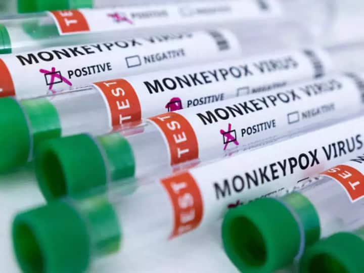Monkeypox Case in India Sixth Case Registered Nigerian man with no recent travel history tests positive for monkeypox Monkeypox Case India : దిల్లీలో మరో మంకీపాక్స్ కేసు, నైజీరియన్ కు పాజిటివ్