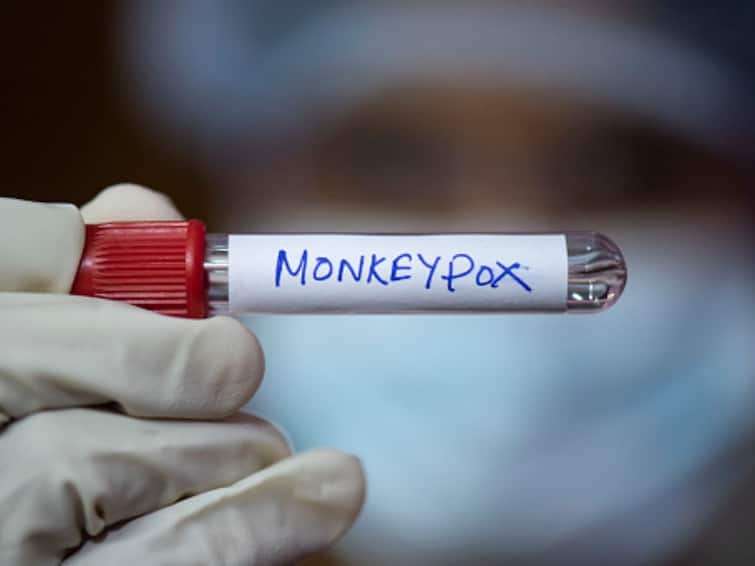 Monkeypox Death Kerala Man Tested Positive Dies In Thrissur Government Initiates High-Level Inquiry Kerala: Youth Who Died In Thrissur Had Monkeypox, NIV Confirms. High-Level Probe On
