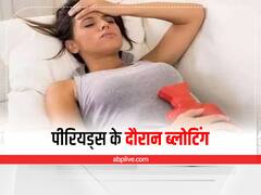 Women Health : पीरियड्स के दौरान हो रही है ब्लोटिंग की समस्या, इन टिप्स से पाएं राहत