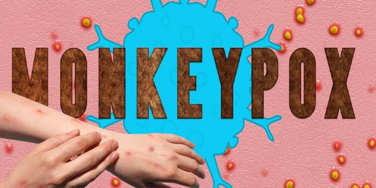 Monkeypox Cases in India Kerala Reports 5th Case as of now total 7 cases in india Monkeypox Cases in India: কেরলে সংক্রমিত আরও ১, দেশে মাঙ্কিপক্স আক্রান্ত মোট ৭, আরও ২ জনের রিপোর্টের অপেক্ষা