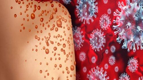 ਮੰਕੀਪੌਕਸ ਵਾਇਰਸ ਇੱਕ ਡਬਲ-ਸਟ੍ਰੈਂਡਡ ਡੀਐਨਏ ਵਾਇਰਸ ਹੈ, ਜੋ ਪੌਕਸਵੀਰਡੇ ਪਰਿਵਾਰ ਦੇ ਆਰਥੋਪੋਕਸਵਾਇਰਸ ਜੀਨਸ ਨਾਲ ਸਬੰਧਤ ਹੈ।