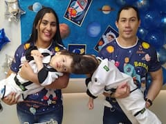 Conjoined Twins: 27 గంటల పాటు 100 మంది వైద్యుల కష్టం, అవిభక్త కవలలకు పునర్జన్మ - ఉపయోగపడిన వర్చువల్ రియాల్టీ టెక్నాలజీ