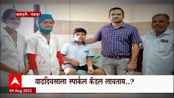 Chandrapur Sparkle Blast :सावधान ! बर्थडे केकवर स्पार्कल कॅन्डल लावताय? तर काळजी घ्या, कारण...