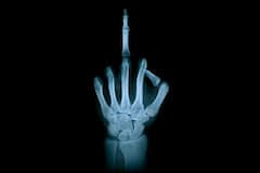 Health Tips: ট্রেকিংয়ে যাচ্ছেন? চোট এড়াতে অবশ্যই মাথায় রাখুন নিয়মগুলি