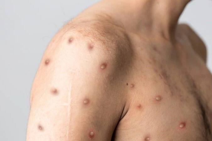 এই পরিস্থিতিতে সতর্ক হওয়ার পরামর্শ দিয়েছে কেন্দ্রীয় সরকার। কোনওরকম গুজবে কান না দিয়ে, এই অবস্থায় কী কী করণীয় তা নিয়ে এক নির্দেশিকাও জারি করেছেন।