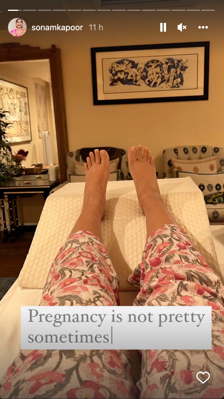 Sonam Kapoor Drops A Pic Of Her Swollen Feet, Says 'Pregnancy Is Not Pretty Sometimes