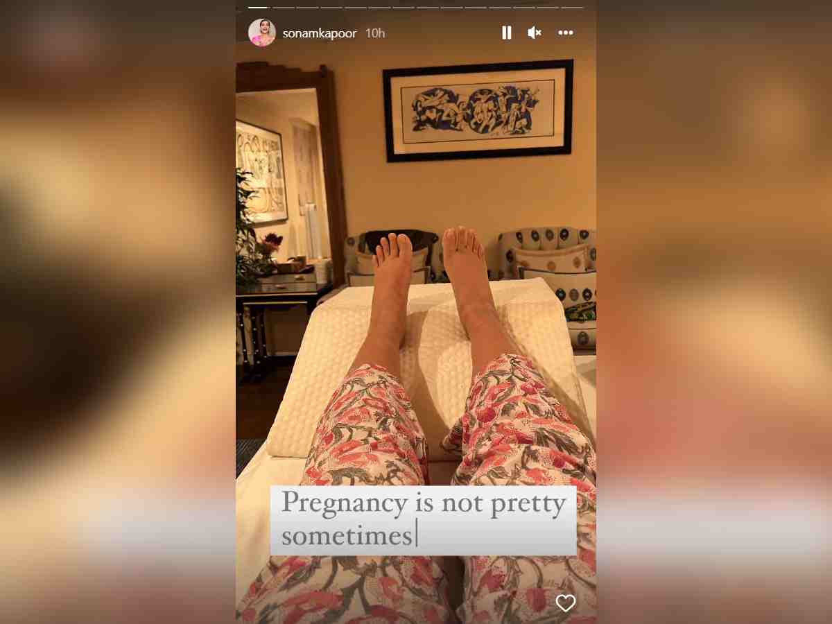 Sonam Kapoor : अभिनेत्री सोनम कपूरने सोशल मीडियावर शेअर केले सुजलेल्या पायाचे फोटो! म्हणाली ‘आई होणं कधी कधी...’