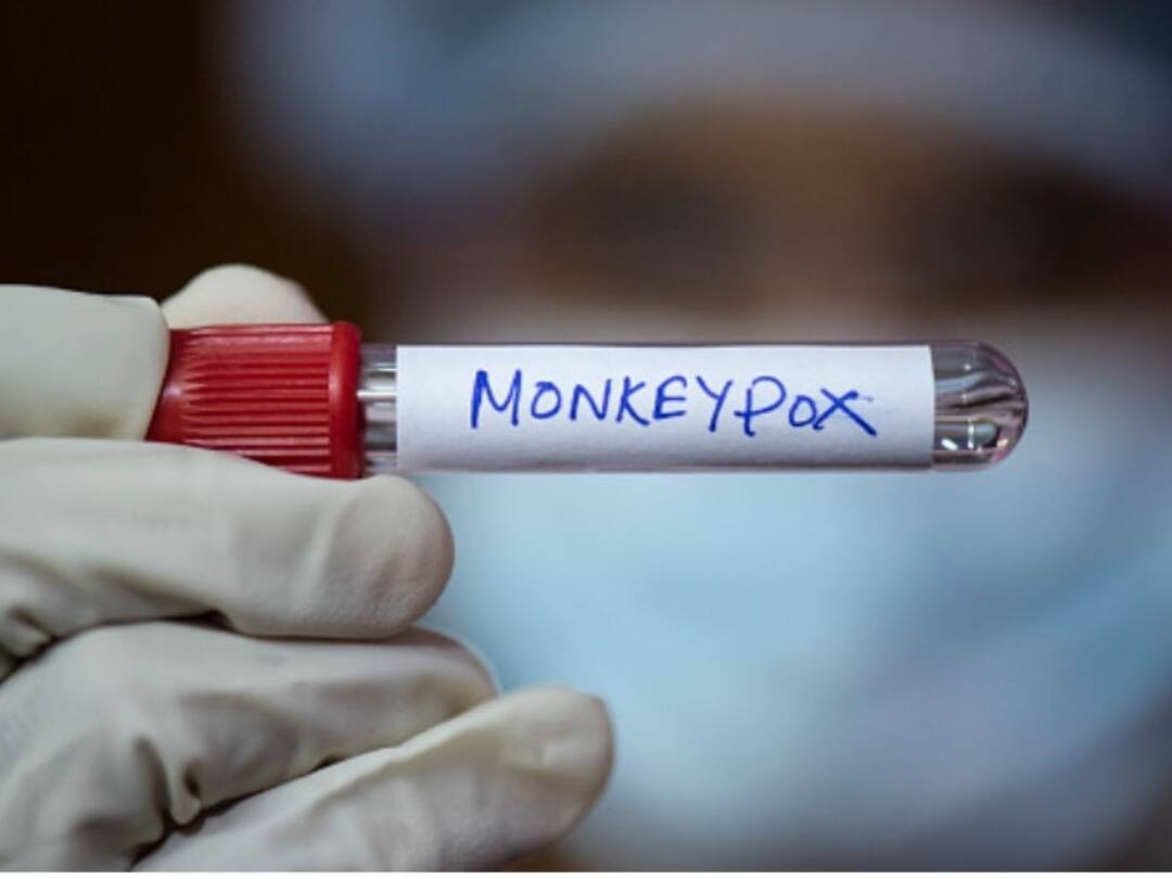 Monkeypox outbreak US: అమెరికాలో హెల్త్ ఎమర్జెన్సీ, మంకీపాక్స్ కేసులు పెరుగుదలతో నిర్ణయం Biden Administration Declares Monkeypox outbreak a public health emergency in the U.S Monkeypox outbreak US: అమెరికాలో హెల్త్ ఎమర్జెన్సీ, మంకీపాక్స్ కేసులు పెరుగుదలతో నిర్ణయం