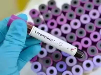 Tamil Nadu logs 1,141 new Covid -19 cases, NO deaths in 24 hours TNCoronaUpdate: ஆயிரத்துக்கும் குறையாத பாதிப்பு! தமிழ்நாட்டில் இன்றைய கொரோனா நிலவரம்!