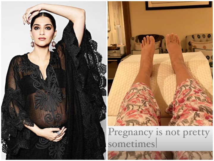 Sonam Kapoor Drops A Pic Of Her Swollen Feet, Says 'Pregnancy Is Not Pretty Sometimes' Sonam Kapoor Drops A Pic Of Her Swollen Feet, Says 'Pregnancy Is Not Pretty Sometimes'