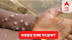 Monkeypox : ভয়ঙ্কর সংক্রমণ, মাঙ্কিপক্সকে জনস্বাস্থ্যে জরুরি অবস্থা ঘোষণা করল আমেরিকা