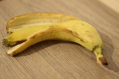 Banana Peel: কলার খোসা ফেলে দেন? এর কত গুণ জানেন?
