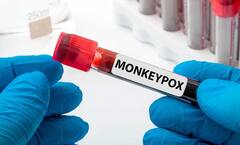 Monkeypox : ਜੇਕਰ ਤੁਸੀ Monkeypox ਤੋਂ ਸੰਕ੍ਰਮਿਤ ਹੋ ਤਾਂ ਕੀ ਕਰਨਾ ਚਾਹੀਦਾ ? ਕਿਹੜੀਆਂ ਸਮੱਸਿਆਵਾਂ ਦਾ ਸਾਮ੍ਹਣਾ ਕਰਨਾ ਪੈਂ ਸਕਦੈ ? ਲੱਛਣਾਂ ਤੇ ਰੋਕਥਾਮ ਨੂੰ ਆਸਾਨ ਭਾਸ਼ਾ 'ਚ ਸਮਝੋ