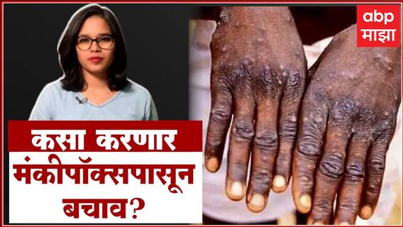 Remedies on Monkeypox : मंकीपॉक्सपासून वाचायचंय? करायचं काय? कसा करणार बचाव? ABP | Fitness Majha
