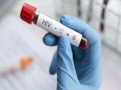 Assam: फेसबुक पर हुआ HIV पॉजिटिव लड़के से इश्क, प्यार साबित करने के लिए युवती ने उठाया ये खौफनाक कदम