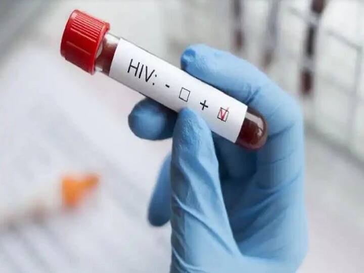 Assam Girl Injected Hiv Positive Boyfriend Blood In Her Body Assam: फेसबुक पर हुआ HIV पॉजिटिव लड़के से इश्क, प्यार साबित करने के लिए युवती ने उठाया ये खौफनाक कदम