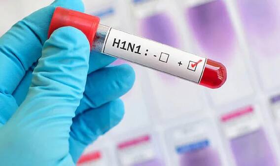 Swine Flu: મહેસાણામાં સ્વાઈન ફ્લૂનાં કારણે એક વ્યક્તિનું મોત, આરોગ્ય વિભાગ આવ્યું હરકતમાં Swine Flu: મહેસાણામાં સ્વાઈન ફ્લૂનાં કારણે એક વ્યક્તિનું મોત, આરોગ્ય વિભાગ આવ્યું હરકતમાં