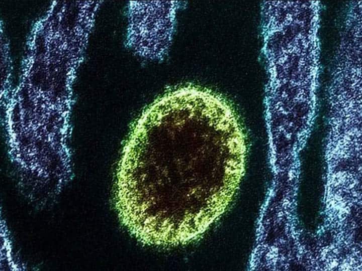 Zoonotic Langya virus: अब चीन में मिला 'जूनोटिक लांग्या वायरस', 35 लोग हुए संक्रमित, जानिए कितना खतरनाक है