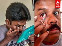 Coimbatore News:  கண்ணில் தேசியக்கொடி.. கோவை தொழிலாளியின் வித்தியாசமான விபரீத முயற்சி..