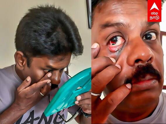 Coimbatore News:  கண்ணில் தேசியக்கொடி.. கோவை தொழிலாளியின் வித்தியாசமான விபரீத முயற்சி..