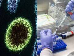Langya Virus: कोरोना के बाद चीन में नए वायरस से हड़कंप - 35 लोग संक्रमित, जानें क्या हैं लक्षण और कितना है खतरनाक