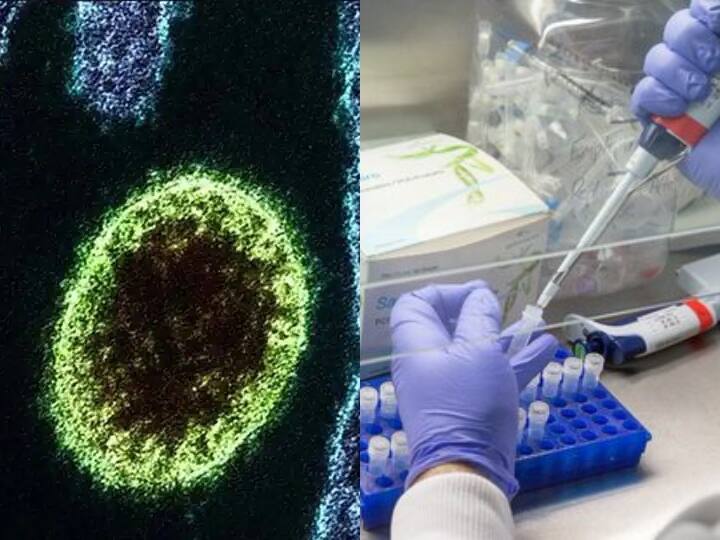 China Confirms Outbreak New Zoonotic Langya Henipavirus 35 People Infected in Shandong and Henan Province Langya Virus: कोरोना के बाद चीन में नए वायरस से हड़कंप - 35 लोग संक्रमित, जानें क्या हैं लक्षण और कितना है खतरनाक