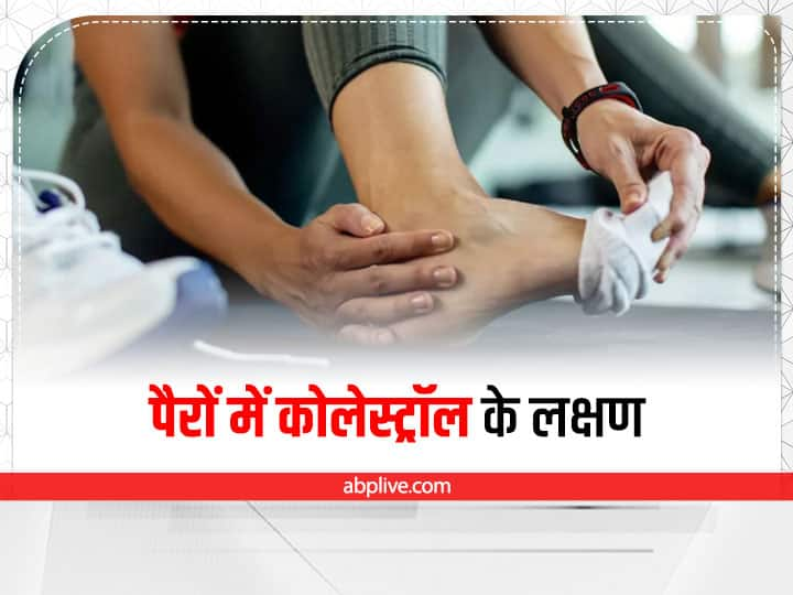 high cholesterol symptoms on feet High Cholesterol: पैरों में दिखने वाले ये लक्षण कोलेस्ट्रॉल की हो सकती है निशानी, तुरंत कराएं इलाज