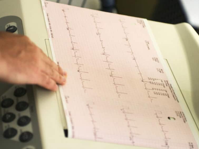 Indian Scientists Develop AI Algorithm That Can Predict Diabetes From ECG