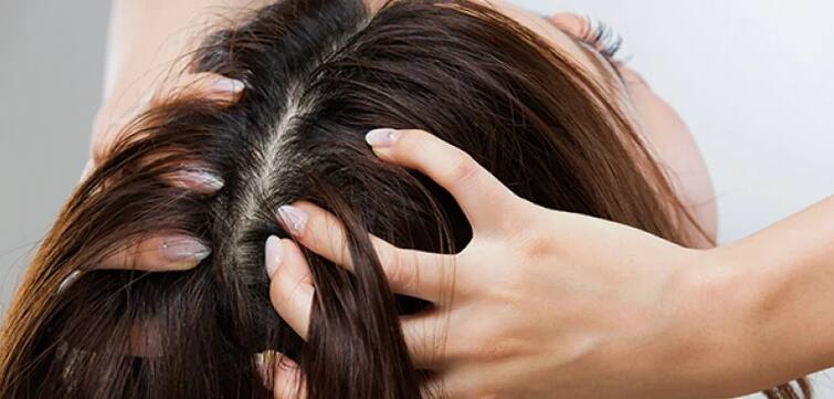 Hair Care: There is itching in the head, there may be a problem of dry scalp, let's know the home remedies for its prevention. Hair Care : ਸਿਰ 'ਚ ਰਹਿੰਦੀ ਹੈ ਖੁਜਲੀ, ਹੋ ਸਕਦੀ ਹੈ ਡਰਾਈ ਸਕੈਲਪ ਦੀ ਸਮੱਸਿਆ, ਆਓ ਜਾਣੀਏ ਇਸਦੀ ਰੋਕਥਾਮ ਦੇ ਘਰੇਲੂ ਨੁਸਖੇ