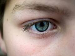 Eyesight: सुअर की त्वचा ने बची 20 मरीजों की आंखों की रोशनी, रिसर्चर्स ने इस तरह किया कॉर्निया ‘इम्प्लांट’