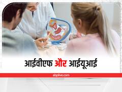 IVF: प्रेग्नेंसी के लिए लेना है आईवीएफ का सहारा तो यहां दूर करें ये सभी कंफ्यूजन