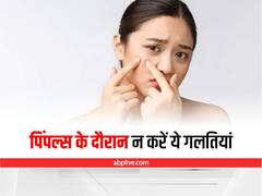 Skin Care : पिंपल होने पर न करें ये गलतियां, वरना बढ़ सकती है परेशानियां