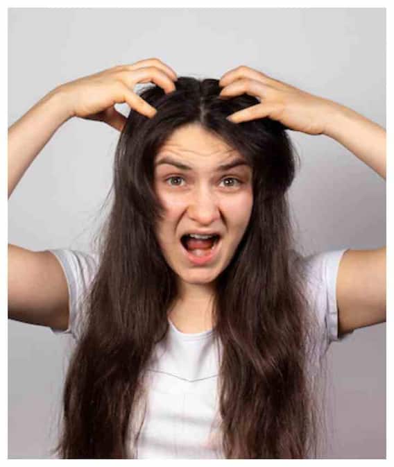 बालों की खुजली दूर करने का तरीका