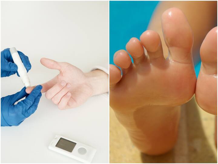 Diabetes Signs In Your Feet You Should Never Ignored Diabetes: మీకు డయాబెటిస్ ఉందో లేదో మీ పాదాలు చెప్పేస్తాయ్