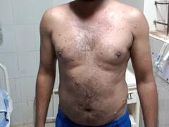 ब्रिटेन में मिला मंकीपॉक्स का नया स्ट्रेन, एक्सपर्ट्स बोले- हो सकता है पहले से भी ज्यादा घातक