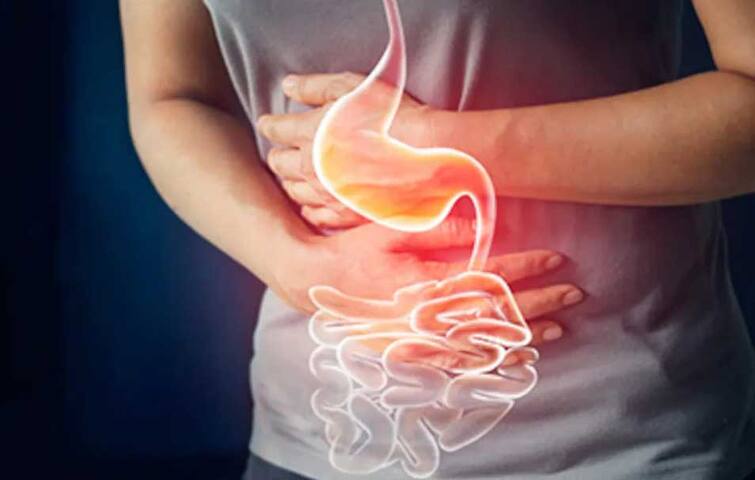 Health Tips: क्या आपके खाने और लाइफस्टाइल में शामिल हैं ये 10 चीजें, तो बढ़ सकती है गैस की समस्या Cause Of Gas And Bloating How To Prevent Gas Problem Health Tips: क्या आपके खाने और लाइफस्टाइल में शामिल हैं ये 10 चीजें, तो बढ़ सकती है गैस की समस्या