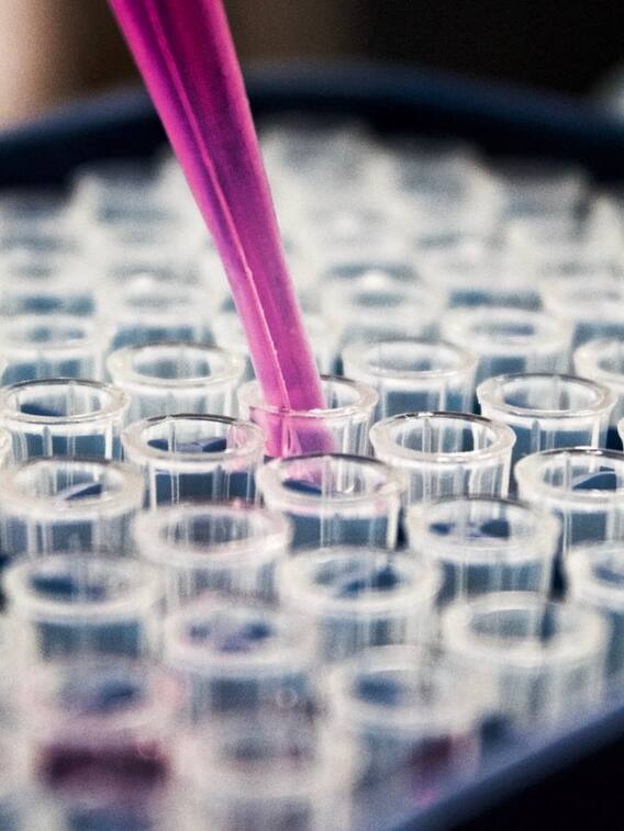 அச்சுறுத்தும் குரங்கு அம்மை!