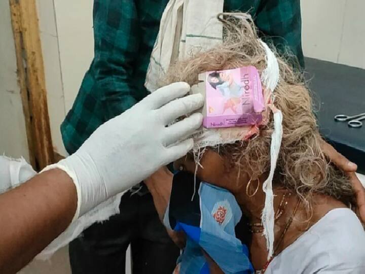 Head Wound Dressed With Condom Pack At Madhya Pradesh Health Centre அதிர்ச்சி வைத்தியம்! தலைக்காயத்திற்கு ஆணுறை பாக்கெட்டை வைத்துக்கட்டிய சுகாதாரப் பணியாளர்.. என்ன நடந்தது?